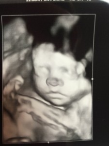 Baby Campbell Ultrasound